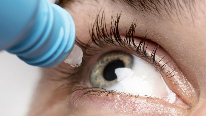 Glaucoma: la relevancia de los factores hereditarios y la prevención